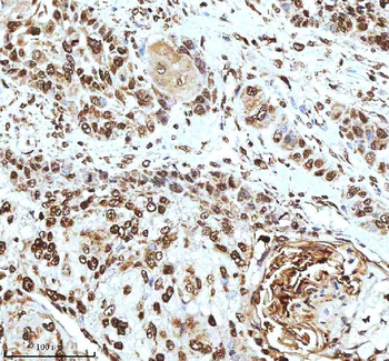 Histone H3 HIST1H3A/B/C/D/E/F/G/H/I/J Rabbit Polyclonal Antibody