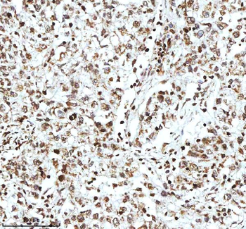Histone H3 HIST1H3A/B/C/D/E/F/G/H/I/J Rabbit Polyclonal Antibody