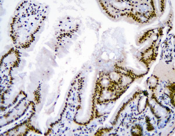 hnRNP D/AUF1/HNRNPD Rabbit Polyclonal Antibody