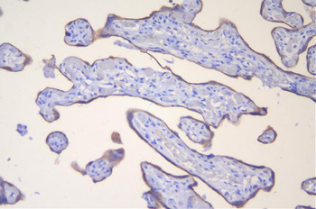 HSD3B1 Rabbit Polyclonal Antibody