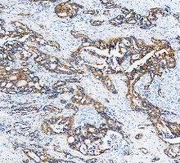 Cytokeratin 20/Krt20 Rabbit Polyclonal Antibody