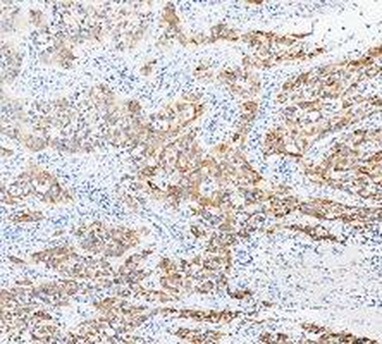 Cytokeratin 20/Krt20 Rabbit Polyclonal Antibody