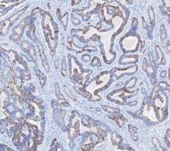 Cytokeratin 20/Krt20 Rabbit Polyclonal Antibody