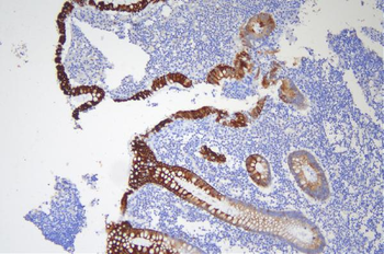 Cytokeratin 20/Krt20 Rabbit Polyclonal Antibody
