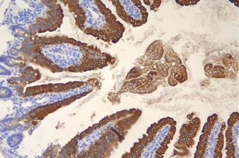Cytokeratin 20/Krt20 Rabbit Polyclonal Antibody