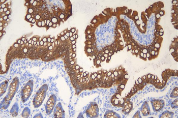 Cytokeratin 20/Krt20 Rabbit Polyclonal Antibody