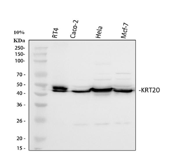 Cytokeratin 20/Krt20 Rabbit Polyclonal Antibody
