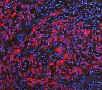 Cytokeratin 20/Krt20 Rabbit Polyclonal Antibody