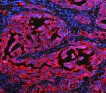 Cytokeratin 20/Krt20 Rabbit Polyclonal Antibody