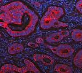 Cytokeratin 20/Krt20 Rabbit Polyclonal Antibody