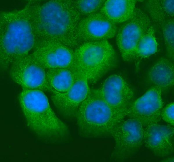 Cytokeratin 20/Krt20 Rabbit Polyclonal Antibody