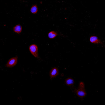 Cytokeratin 20/Krt20 Rabbit Polyclonal Antibody