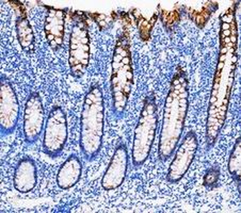 Cytokeratin 20/Krt20 Rabbit Polyclonal Antibody