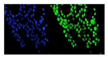 NUP214 Rabbit Polyclonal Antibody