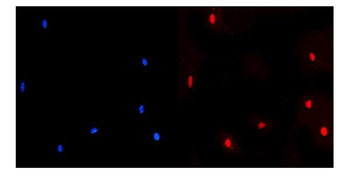 NUP214 Rabbit Polyclonal Antibody