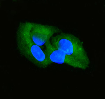 SFRP2 Rabbit Polyclonal Antibody