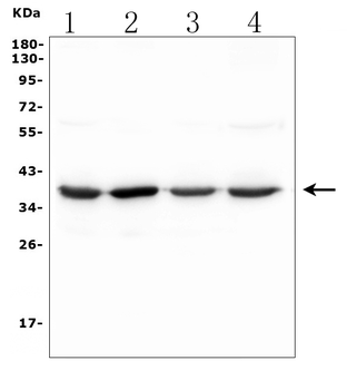 SFRP2 Rabbit Polyclonal Antibody