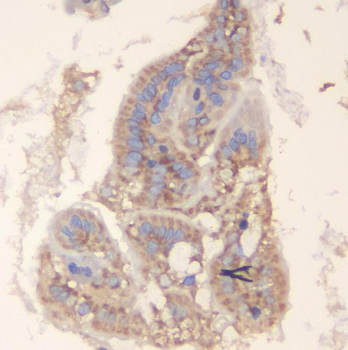 TRAF6 Rabbit Polyclonal Antibody