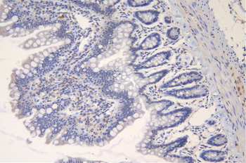 TRAF6 Rabbit Polyclonal Antibody