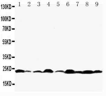 Apoptosis regulator BAX Bax Rabbit Polyclonal Antibody