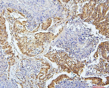 SAE2/UBA2 Mouse Monoclonal Antibody