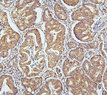 SAE2/UBA2 Mouse Monoclonal Antibody