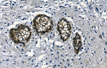 GAA Mouse Monoclonal Antibody