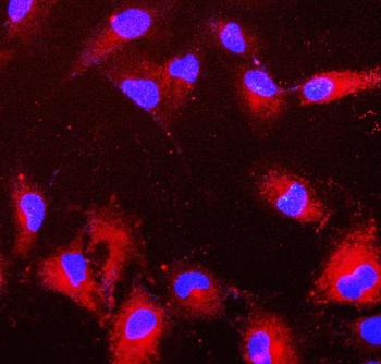 PRDX6 Mouse Monoclonal Antibody