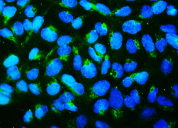Mitofusin 1 MFN1 Mouse Monoclonal Antibody