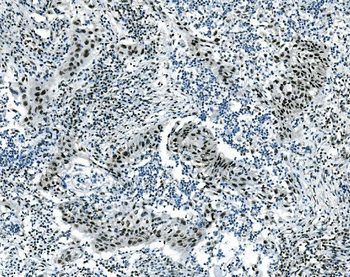 Musashi 1/Msi1 Mouse Monoclonal Antibody