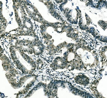 Musashi 1/Msi1 Mouse Monoclonal Antibody