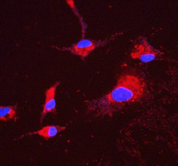 ATP5H in Mouse Monoclonal Antibody