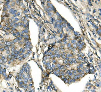 ATP5H in Mouse Monoclonal Antibody