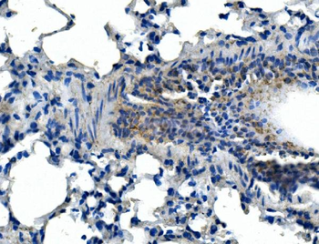 Adam28 Rabbit Polyclonal Antibody