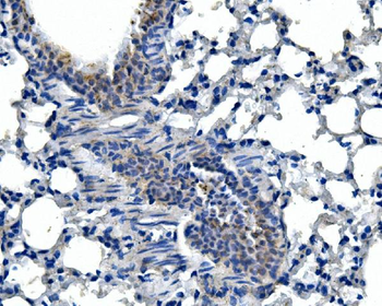 Adam28 Rabbit Polyclonal Antibody