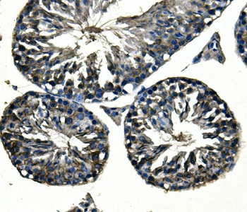 Adam28 Rabbit Polyclonal Antibody