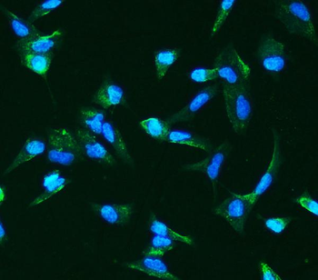 Angiopoietin-2/ANGPT2 Rabbit Polyclonal Antibody