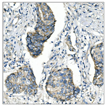 Angiopoietin-2/ANGPT2 Rabbit Polyclonal Antibody