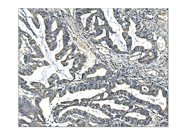 Angiopoietin-2/ANGPT2 Rabbit Polyclonal Antibody