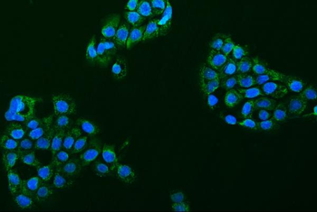 ACCN1/ASIC2 Rabbit Polyclonal Antibody