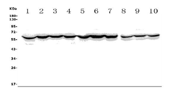 ACCN1/ASIC2 Rabbit Polyclonal Antibody