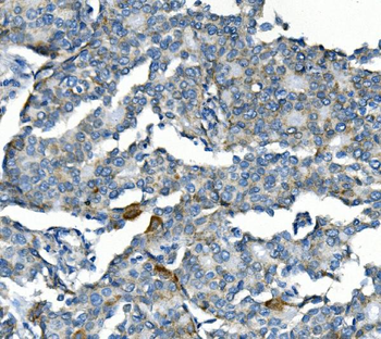 Cyclin B2/CCNB2 Rabbit Polyclonal Antibody