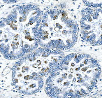 Cyclin B2/CCNB2 Rabbit Polyclonal Antibody