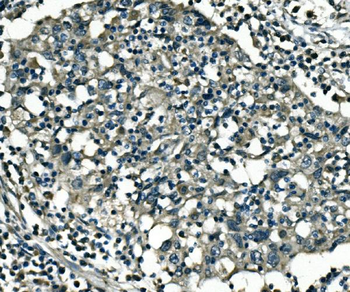 PCTAIRE1/CDK16 Rabbit Polyclonal Antibody