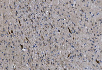 Choline Acetyltransferase/Chat Rabbit Polyclonal Antibody
