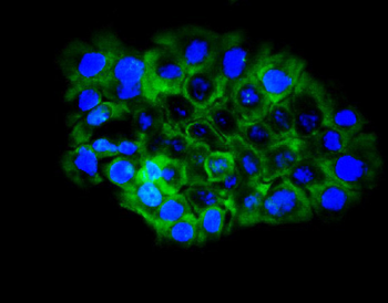 Eph receptor B2/EPHB2 Rabbit Polyclonal Antibody