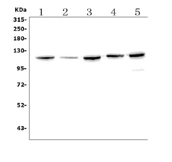 Eph receptor B2/EPHB2 Rabbit Polyclonal Antibody