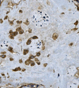 Fibrinogen alpha chain/FGA Rabbit Polyclonal Antibody
