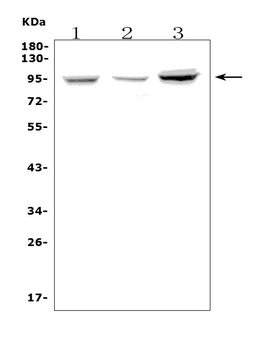 Fibrinogen alpha chain/FGA Rabbit Polyclonal Antibody