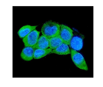 IRAK2 Rabbit Polyclonal Antibody